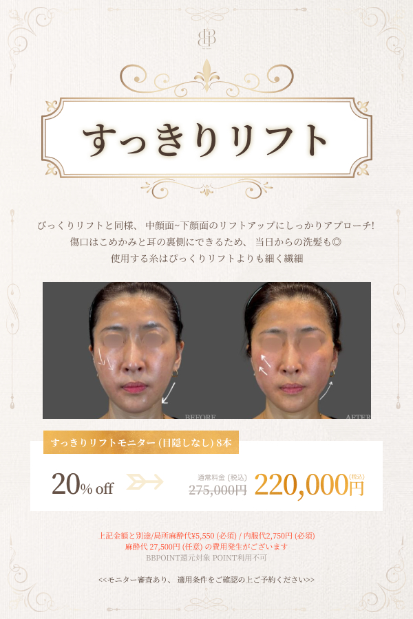 すっきりリフト