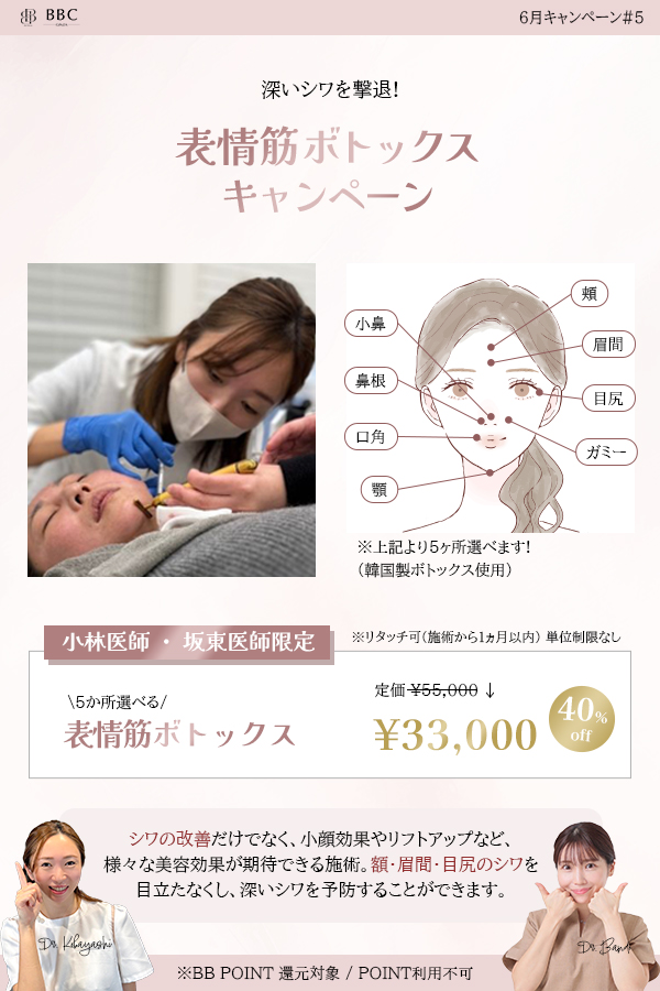 ボトックス