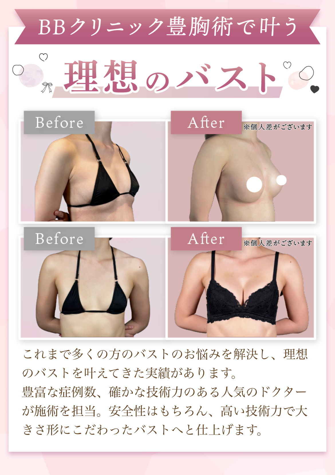 BBCLINIC GINZA